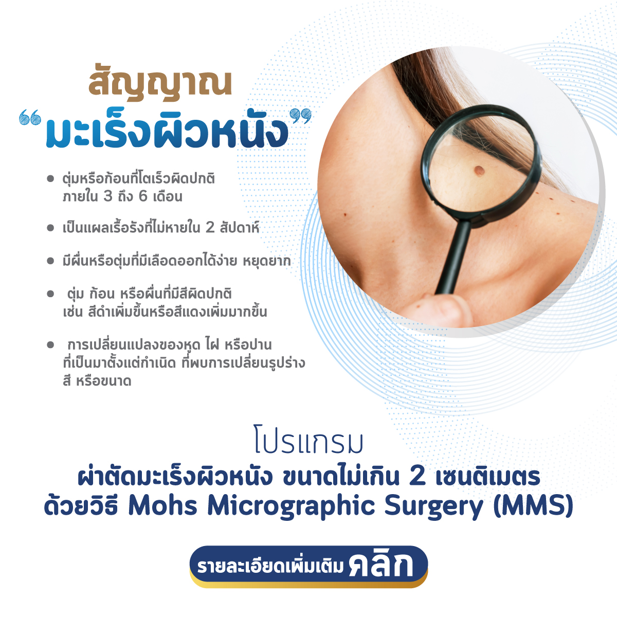 โปรแกรมผ่าตัดมะเร็งผิวหนัง ขนาดไม่เกิน 2 เซนติเมตร ด้วยวิธี Mohs Micrographic Surgery (MMS)